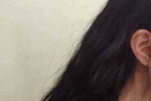 福州渙美醫(yī)療美容門(mén)診部整形價(jià)格表一覽及醫(yī)院介紹