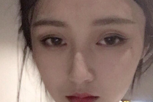 上海文峰醫(yī)療美容門診部整形價格表一覽及醫(yī)院介紹