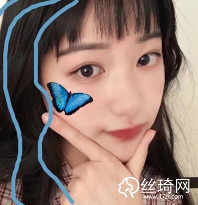 大連光普整形醫(yī)院整形價格表一覽及醫(yī)院介紹