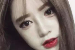 韓國(guó)winners整形外科醫(yī)院整形價(jià)格表一覽及醫(yī)院介紹