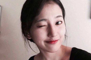 中南大學(xué)湘雅醫(yī)院整形美容科整形價格表一覽及醫(yī)院介紹