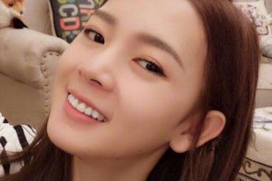 北京阿露絲醫(yī)療美容門診部整形價格表(價目表)一覽及醫(yī)院介紹