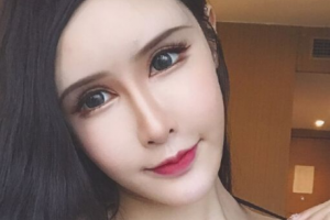 長(zhǎng)春榆樹(shù)陳偉醫(yī)療美容診所整形價(jià)格表(價(jià)目表)一覽及醫(yī)院介紹