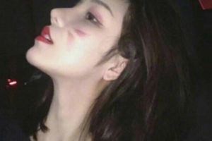 哈爾濱市第一醫(yī)院整形美容科整形價格表(價目表)一覽及醫(yī)院介紹