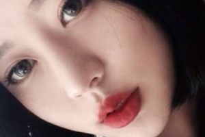 溫州醫(yī)科大學附屬第一醫(yī)院整形美容科整形價格表(價目表)全新發(fā)布