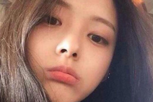 張家港第一人民醫(yī)院燒傷美容整形科整形價(jià)格表(價(jià)目表)全新發(fā)布