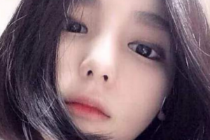 株洲市一醫(yī)院燒傷整形科整形價格表(價目表)一覽及醫(yī)院介紹