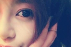 寧夏回族自治區(qū)人民醫(yī)院皮膚科整形價(jià)格表(價(jià)目表)一覽及醫(yī)院介紹