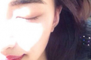 恩施州中心醫(yī)院燒傷整形醫(yī)療美容科整形價(jià)格表(價(jià)目表)一覽及醫(yī)院介紹