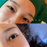 沈陽醫(yī)大一院整形科