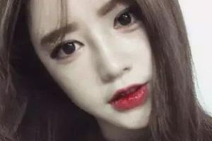 哈醫(yī)大二院整形美容科整形價格表(價目表)全新發(fā)布