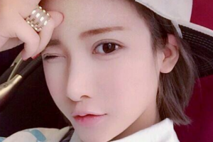 冀中能源峰峰集團有限公司第二醫(yī)院整形價格表(價目表)一覽及醫(yī)院介紹