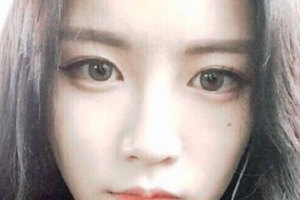 2020北京301整形醫(yī)院整形價格表(價目表)公布