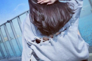 北京美聯臣美容整形醫(yī)院整形價格表(價目表)2020全新發(fā)布