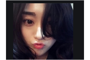 北京大學(xué)第一醫(yī)院整形燒傷外科整形價(jià)格表(價(jià)目表)2020全新發(fā)布