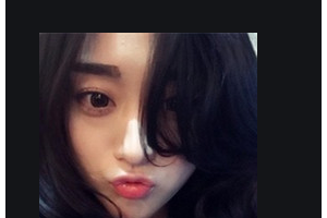 2020佛山市南海區(qū)人民醫(yī)院燒傷整形科整形價格表(價目表)全新發(fā)布