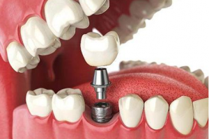 2020沈陽歡樂仁愛口腔醫(yī)院整形價(jià)格表(價(jià)目表)全新發(fā)布