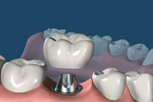 2020沈陽康貝佳口腔門診部整形價(jià)格表(價(jià)目表)全新發(fā)布