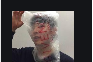 2020長沙佰佳麗醫(yī)療美容門診部整形價格表(價目表)全新發(fā)布