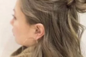 2020大慶生醫(yī)療美容診所整形價(jià)格表(價(jià)目表)全新發(fā)布