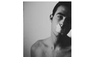 2020深圳市寶安人民醫(yī)院燒傷整形科整形價格表(價目表)全新發(fā)布