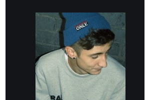 2020孝感君雅口腔門診整形價(jià)格表(價(jià)目表)全新發(fā)布