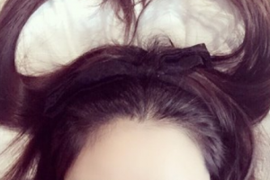 腿部吸脂了解一下！