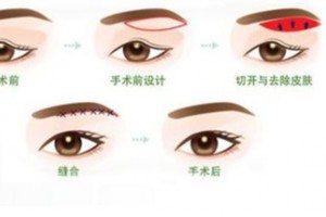 什么是提美術(shù)