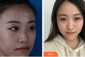 沈陽金皇后整形美容醫(yī)院彭柏勝整形價格表附皮膚美容案例展示