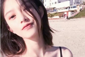 上海時(shí)光整形外科醫(yī)院許黎平整形價(jià)格表附眼部整形案例展示