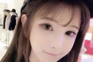 上海美之源整形外科醫(yī)院滕可穎整形價(jià)格表附光子嫩膚案例展示