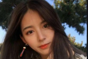 上海紐賽醫(yī)療美容門診部王琳整形價(jià)格表附玻尿酸全臉填充案例展示