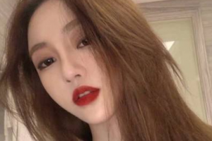 北京亞韓醫(yī)療美容門診部金成植整形價格表附面部吸脂案例展示