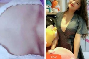 上海解放軍第八五醫(yī)院整形美容科顧海峰整形價(jià)格表附隆胸案例展示