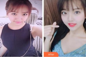 上海時(shí)光整形外科醫(yī)院施悅整形價(jià)格表附自體脂肪隆胸案例展示