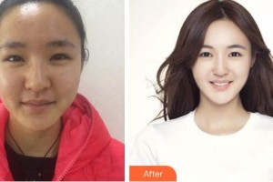 上海宏康醫(yī)院整形美容中心倪芳韻整形價(jià)格表附皇后光子嫩膚案例展示