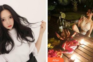 廣州粵秀整形外科醫(yī)院羅錦輝整形價(jià)格表附自體脂肪豐胸案例展示