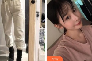 廣州粵秀整形外科醫(yī)院王堅(jiān)強(qiáng)整形價(jià)格表附大腿吸脂案例展示