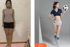 上海德琳醫(yī)療美容醫(yī)院金成德整形價格表附腰腹環(huán)吸+大小腿吸脂案例展示