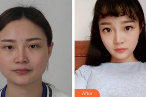 上海天大醫(yī)療美容醫(yī)院熊俊文整形價格表附頜面整形案例展示