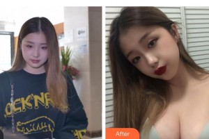 上海麗人整形美容醫(yī)院朱昌整形價格表附假體隆胸案例展示