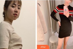 上?？祳W醫(yī)療美容醫(yī)院何玉成整形價格表附光子套餐案例展示