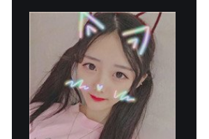 南京康美美容醫(yī)院杜永康整形價格表附肋軟骨隆鼻案例展示