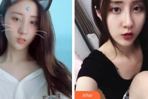 廣州軍區(qū)總醫(yī)院全軍激光整形美容中心齊向東整形價格表附	激光美膚激光祛斑案例展示