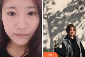 廣州凱美達(dá)整形美容醫(yī)院王之光整形價格表附無針?biāo)獍咐故?>
</a>
<h3 class=