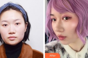 上海藝星醫(yī)療美容醫(yī)院裴宰瑩整形價(jià)格表附埋線雙眼皮+去脂案例展示