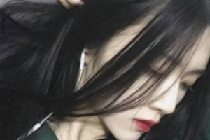 南京康麗整形醫(yī)院劉榮清整形價(jià)格表附假體墊眉弓案例展示