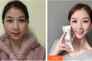 上海藝星醫(yī)療美容醫(yī)院宗建華整形價(jià)格表附[激光美膚祛斑]多方面部激光美膚祛斑案例展示