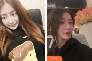 上海比華利整形醫(yī)院劉姝娟主治醫(yī)生整形價格表附鼻修復(fù)+鼻部手術(shù)案例展示