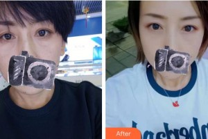 上海清楊整形外科門診部張濱整形價格表附祛眼袋案例展示